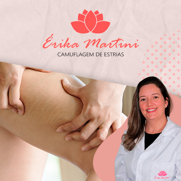 Camuflagem de Estrias Com Érika Martini RECLAME AQUI, Camuflagem de Estrias Com Érika Martini É CONFIÁVEL? Camuflagem de Estrias Com Érika Martini VALE A PENA?