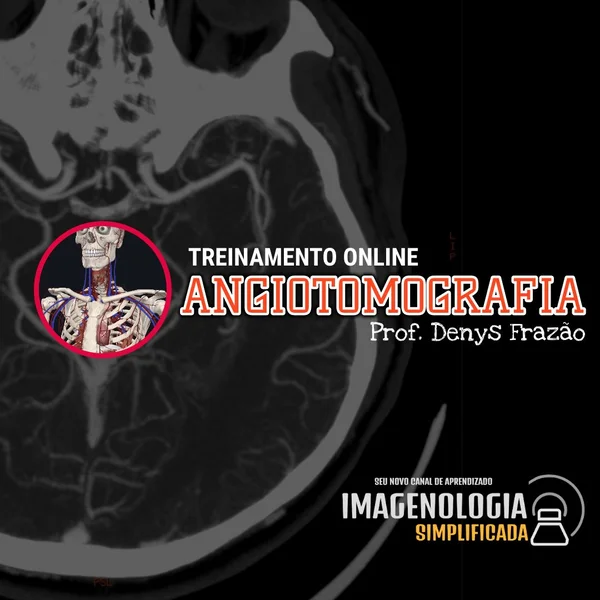 Treinamento Angiotomografia